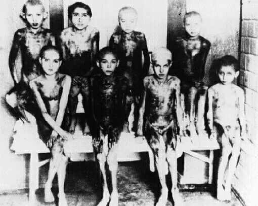 children_who_suffered__nazi_medical_experiments.jpg 
