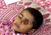 iraqi_boy_tumor_for_confident_generals.jpg
