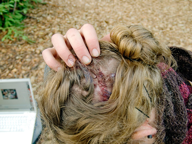 head-gash_11-7-07.jpg 