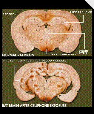 emrratbrain.jpg 