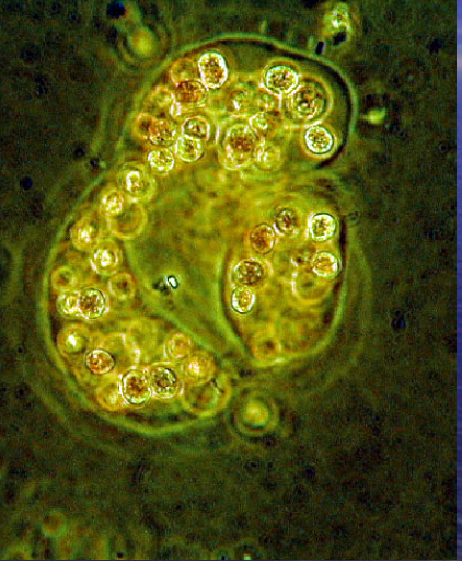 microcytis_cell_close_up.jpg 