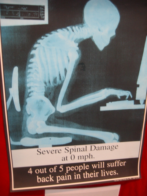 640_v09spinaldamage.jpg 