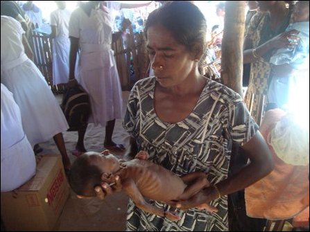 2.5_months_old_baby_sakeela__affected_by_malnutrition_and_admitted_at_the_makeshift_hospital_died_on_tuesday.jpg 