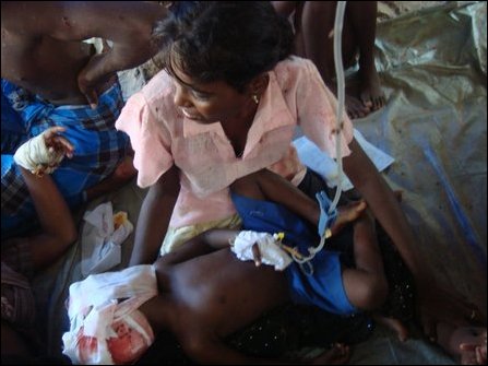 a_seriously_wounded_child_in_sri_lanka_army__sla__shelling_on_wednesday.jpg 