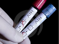 200_hivpoz_vsneg_pic.jpg original image ( 375x373)
