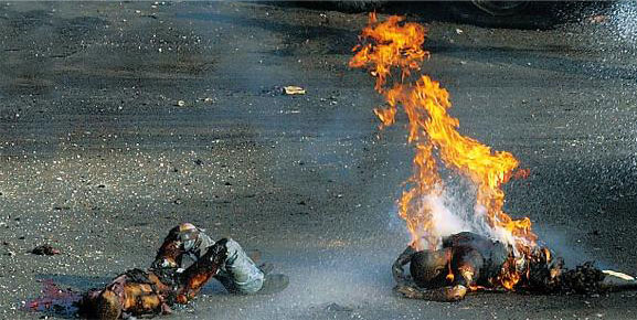 burnt-people-in-lebanon.jpg 