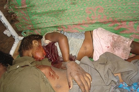 sri-lanka-victims-of-shelling.jpg 