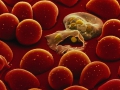 0000000000_malaria-parasites_1059_600x450.jpg