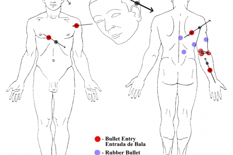 480_autopsy-diagram-luis-gongora-pat_1.jpg