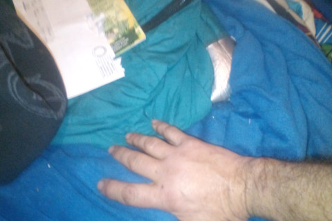 victim is righthanded and was incapacitated for almost a week