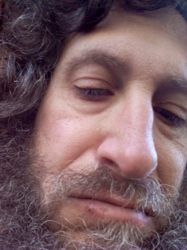 photo of student victim's swollen low lip, jaw, nose 4 days after attack by Lupe